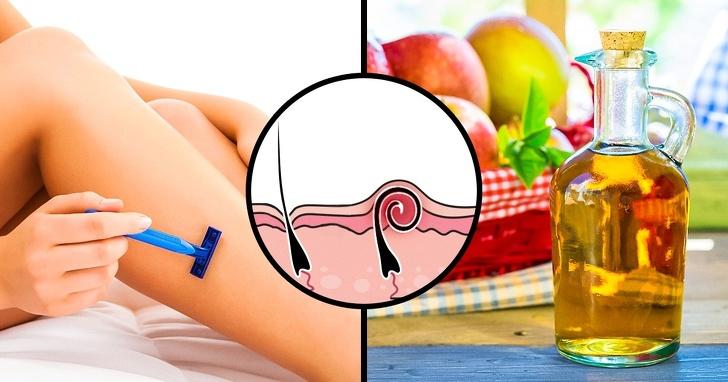 Natural Remedies for