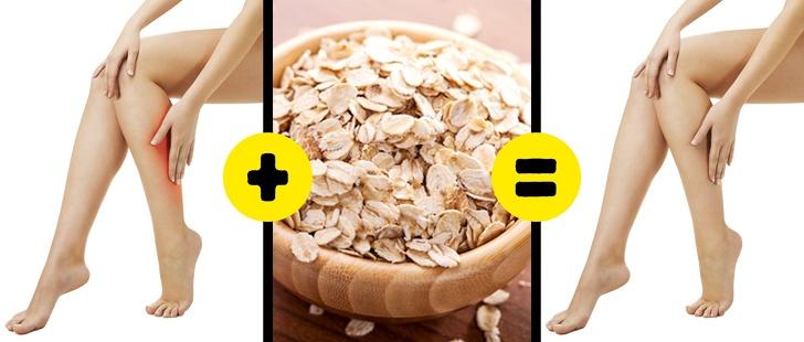 Natural Remedies for